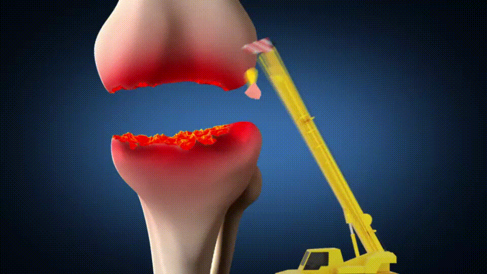 Natural Compounds Behind Knee Pain Discovery